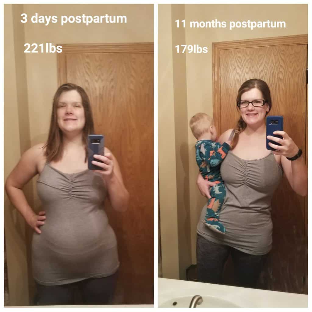 postpartum before and after 
